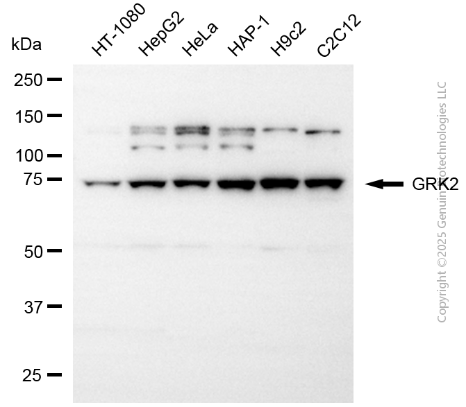 WB - KD-Validated Anti-GRK2 Rabbit Polyclonal Antibody AGI2114